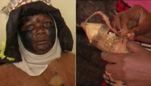Photos & Video: Man, sister in-law caught 'stuck' having sex in Nakuru 3 Witchdoctor